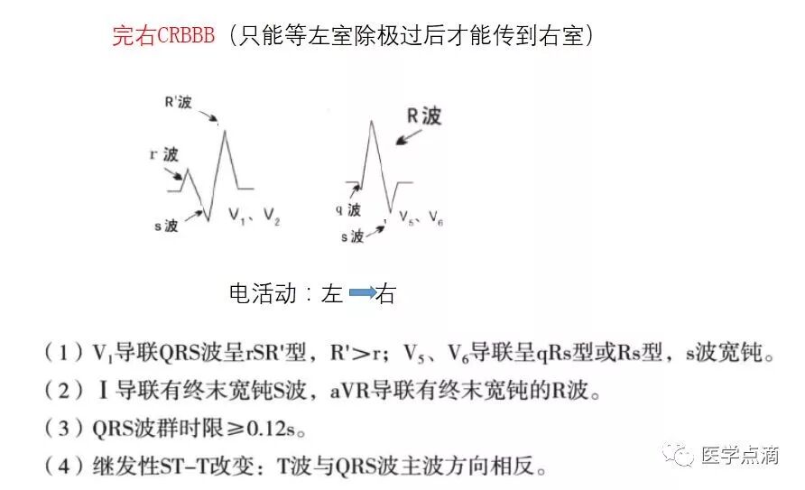 教你用最简单方法学习心电图！