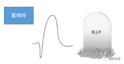 教你用最简单方法学习心电图！