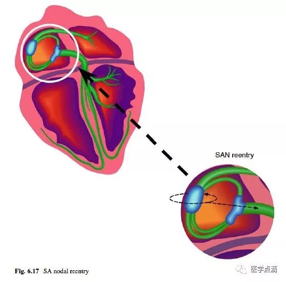 教你用最简单方法学习心电图！