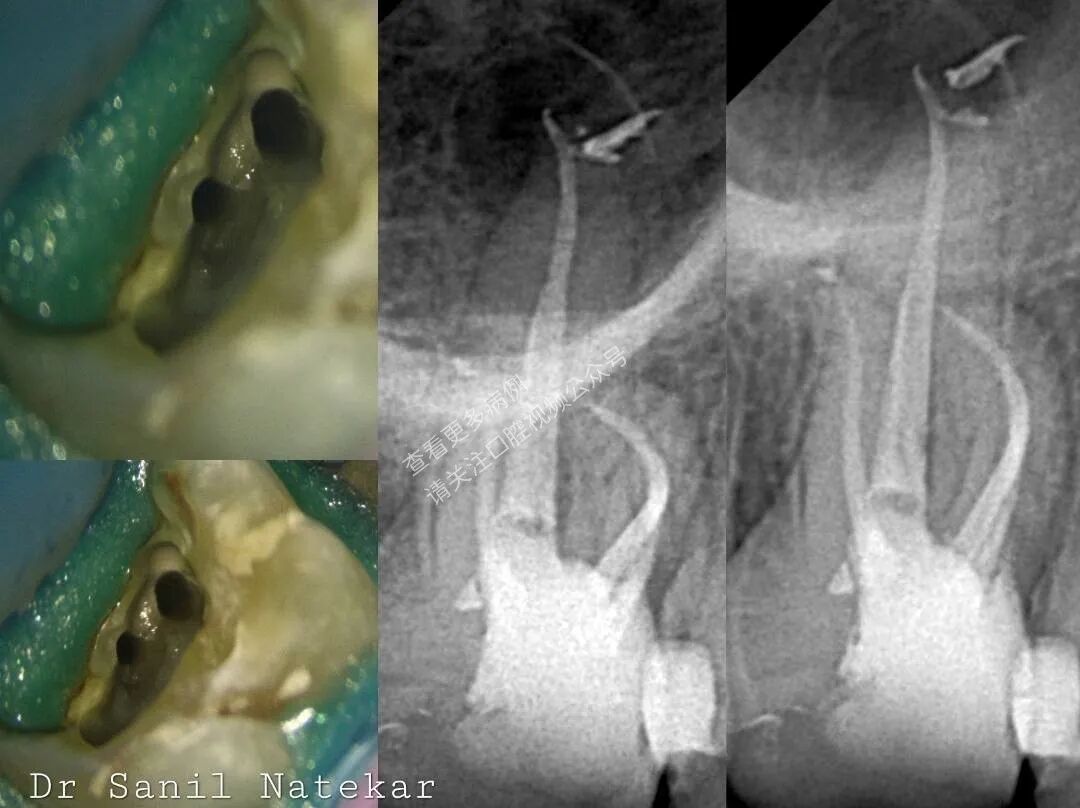 技巧，这样寻找MB2，你认可吗？