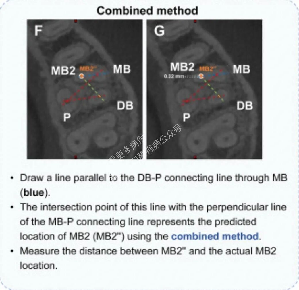 技巧，这样寻找MB2，你认可吗？