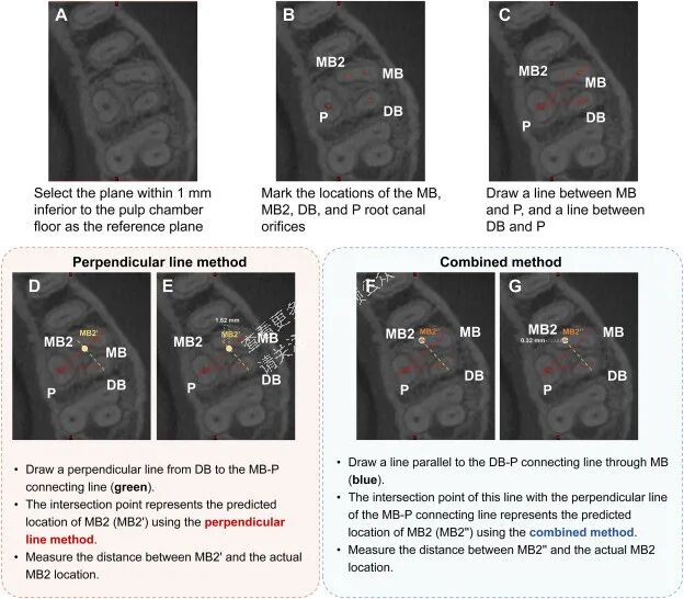 技巧，这样寻找MB2，你认可吗？