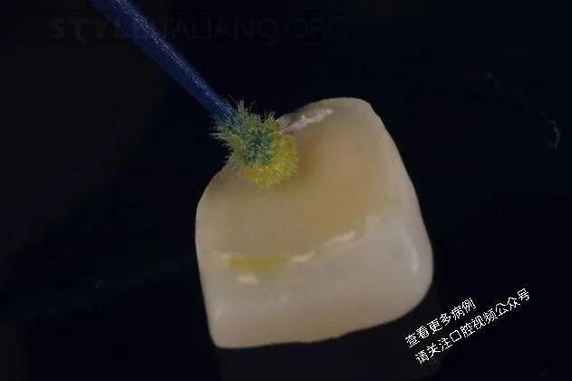 贴面粘接流程:从酸蚀到抛光全步骤(28图详解)
