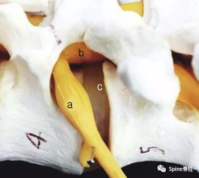 “安全三角”真的安全吗?——脊柱微创里的