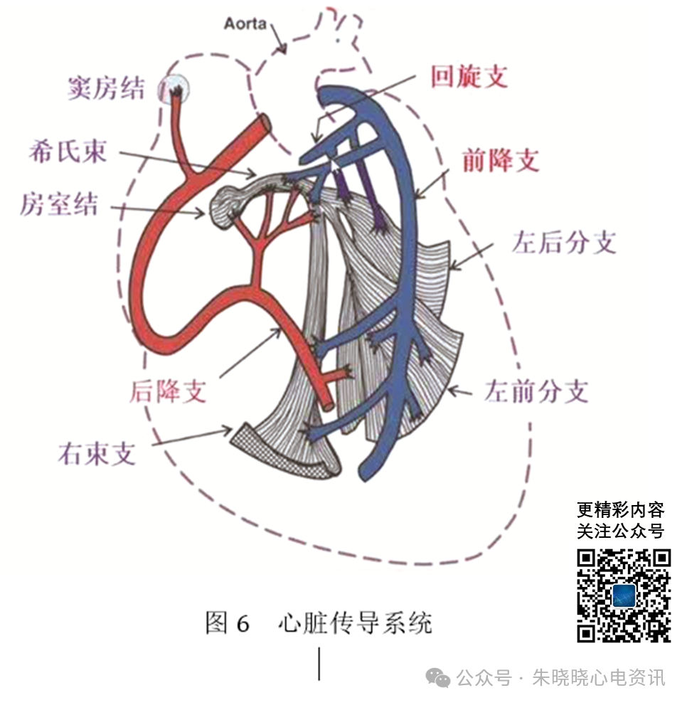 左主干急性完全闭塞的心电图特征