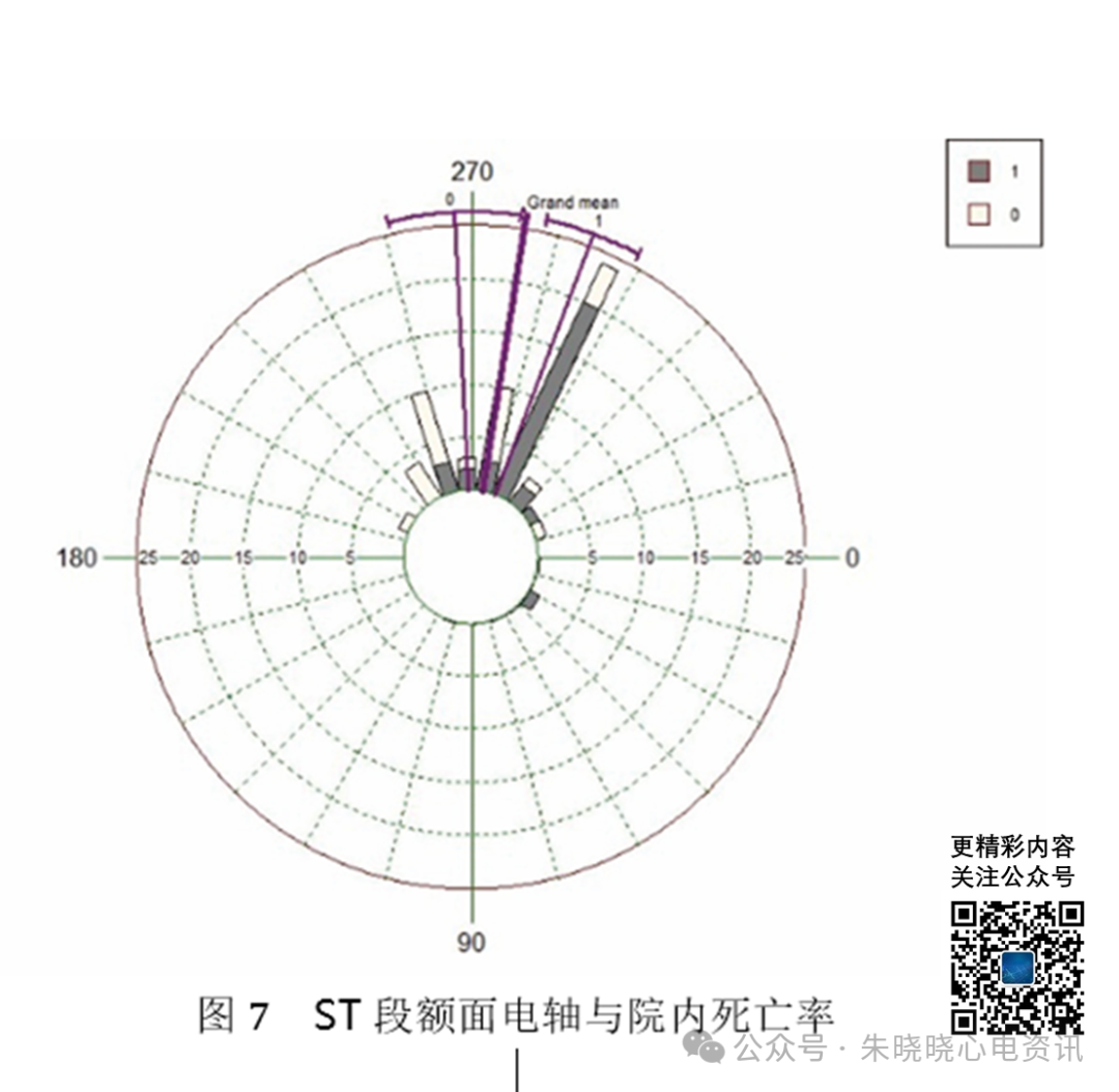 左主干急性完全闭塞的心电图特征