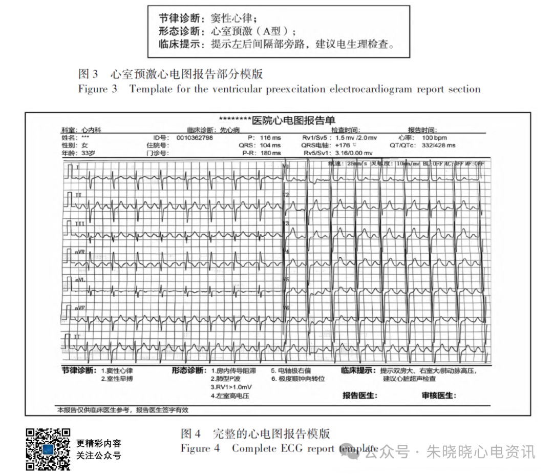 心电图报告规范化书写专家共识(2026