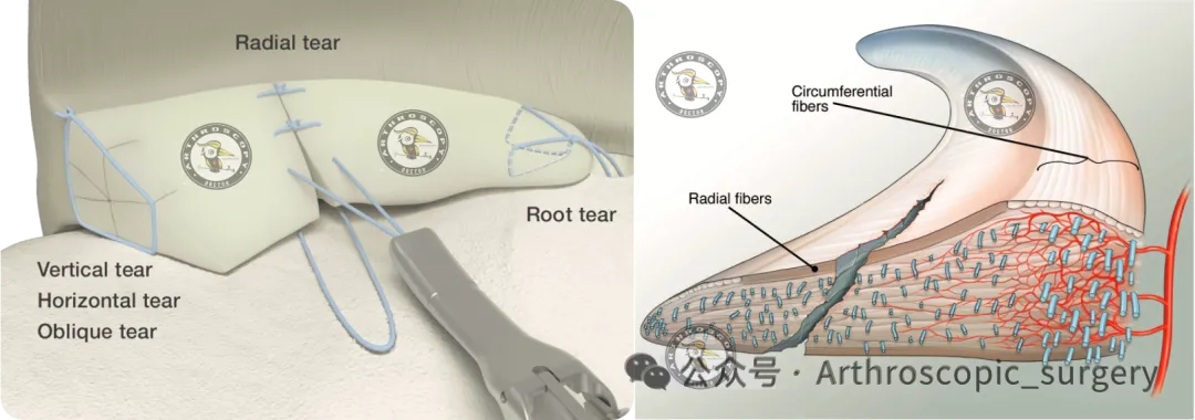 手术理念