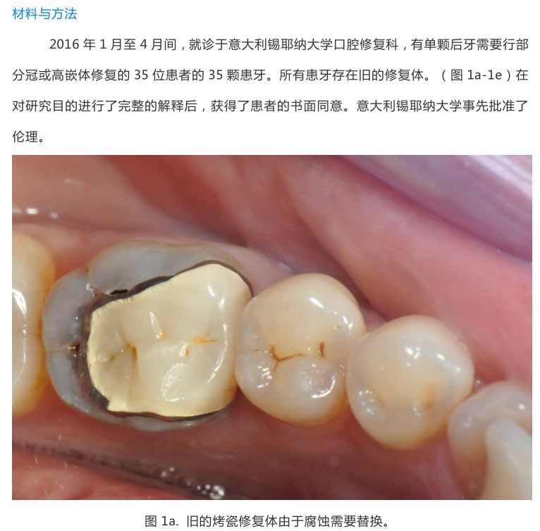 【病例分享】龈壁抬升的研究