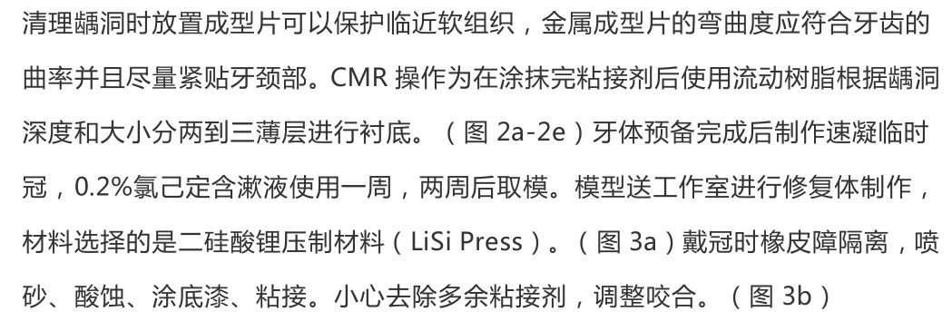 【病例分享】龈壁抬升的研究