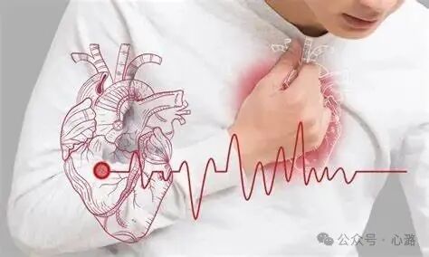 室性早搏与室性逸搏的鉴别