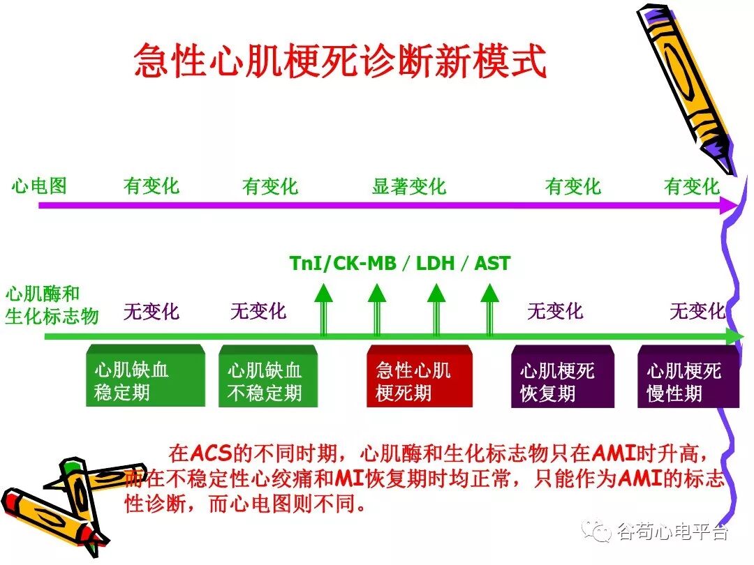 急性心肌梗死新定义（全球统一定义）
