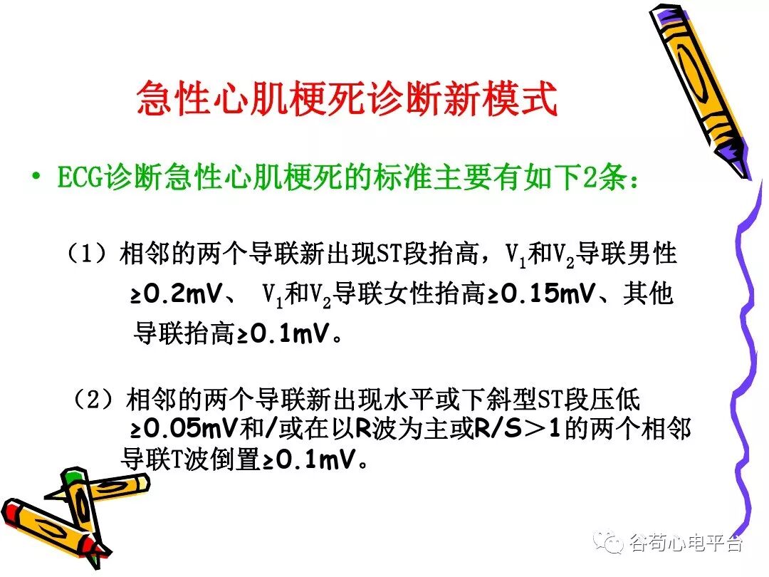 急性心肌梗死新定义（全球统一定义）