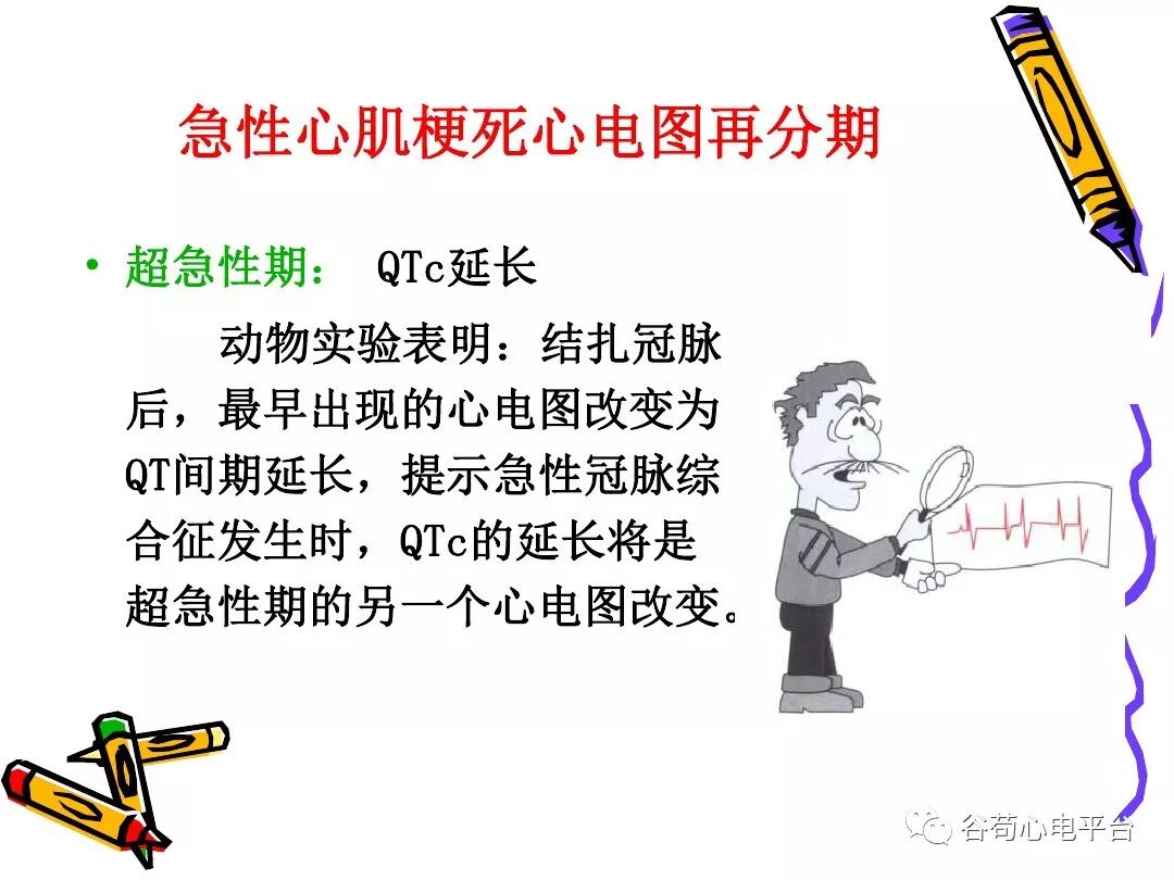 急性心肌梗死新定义（全球统一定义）