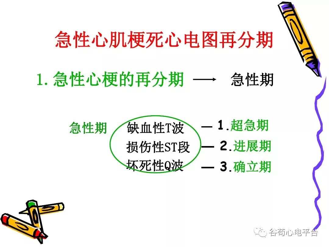 急性心肌梗死新定义（全球统一定义）