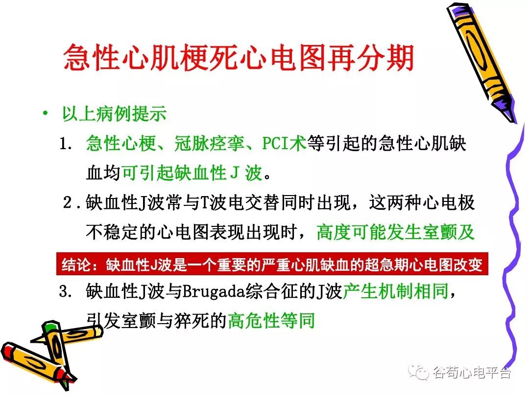 急性心肌梗死新定义（全球统一定义）
