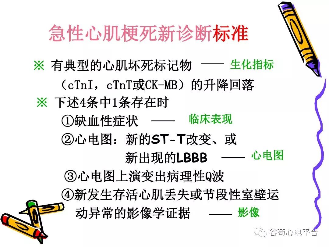 急性心肌梗死新定义（全球统一定义）