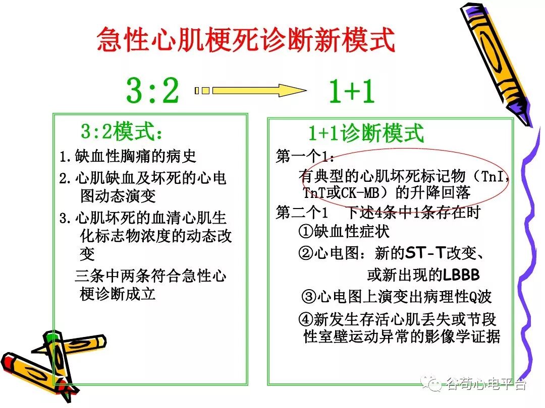 急性心肌梗死新定义（全球统一定义）