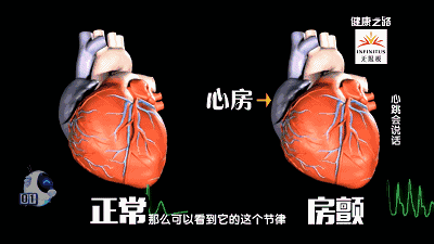 急诊房颤的处理大全