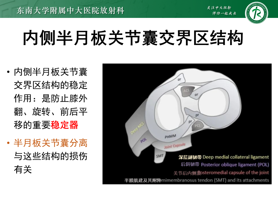 半月板Ramp损伤的解剖与分型