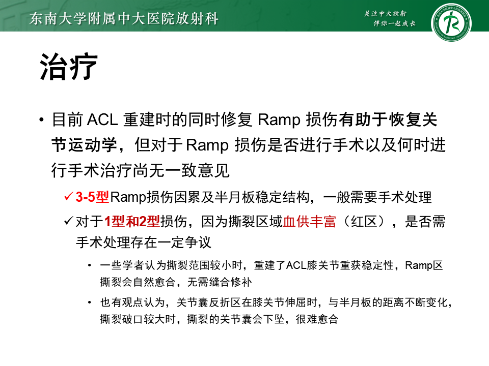 半月板Ramp损伤的解剖与分型