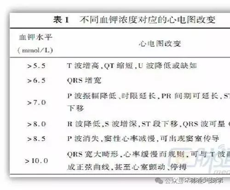 超全讲解！ST段抬高的识别及相关疾病的鉴别