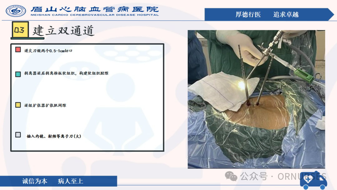 【图文课件】双通道脊柱内镜下(UBE）椎管扩大减压术