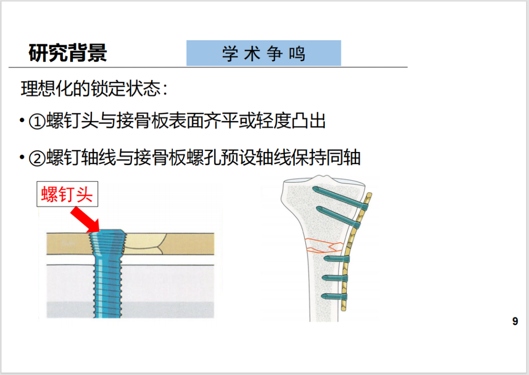 锁定接骨板