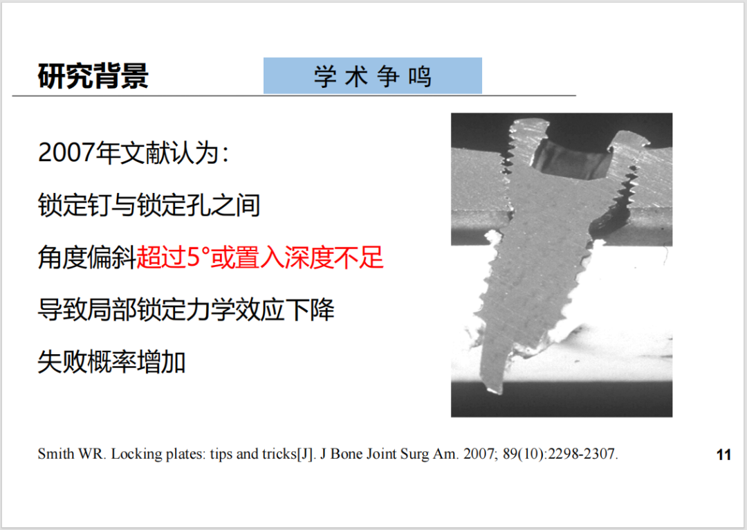 锁定接骨板