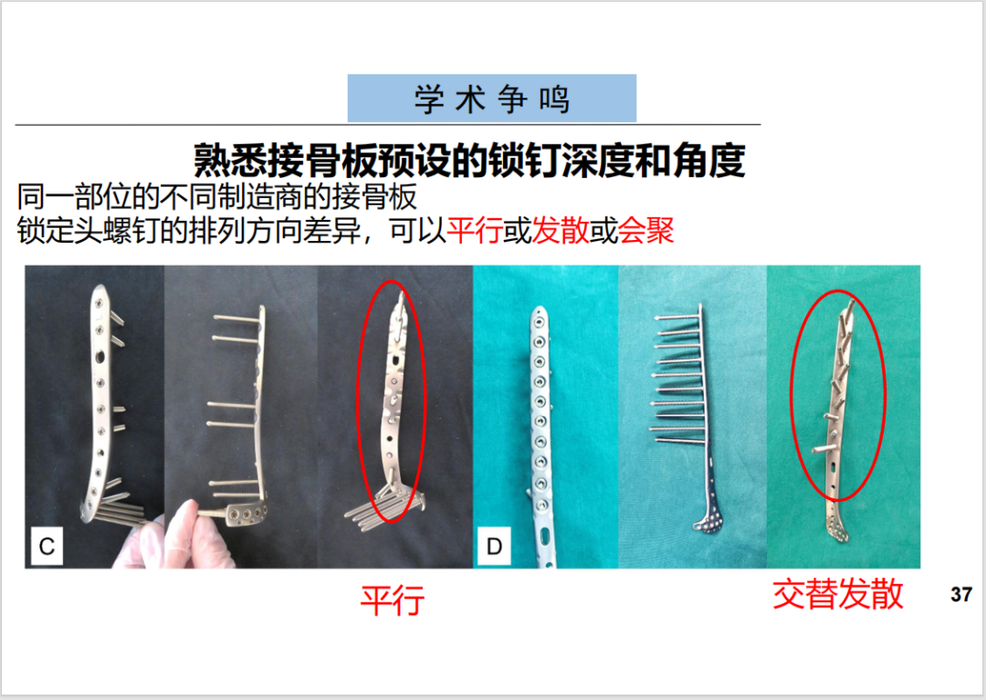 锁定接骨板