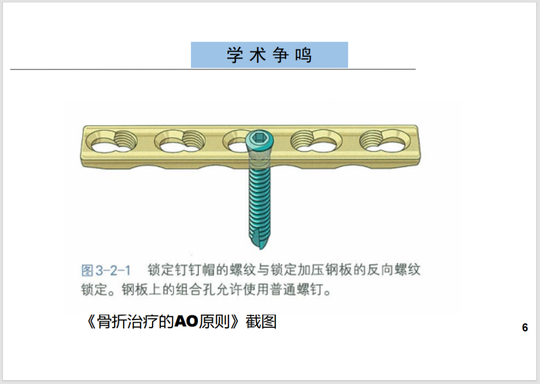 锁定接骨板