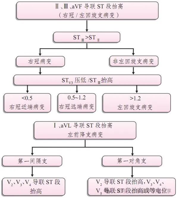 急性心肌梗死心电图定位诊断与梗死相关血管的关系