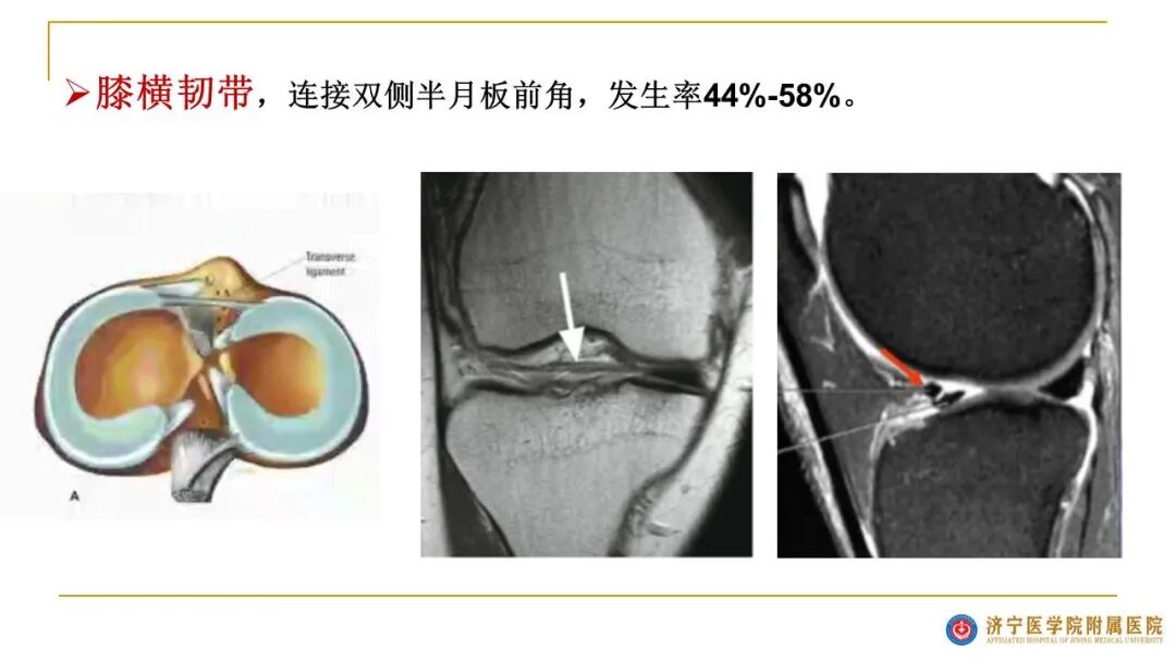 【图文并茂】膝关节MRI解剖及常见病诊断