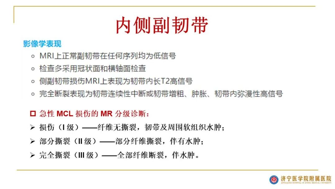 【图文并茂】膝关节MRI解剖及常见病诊断