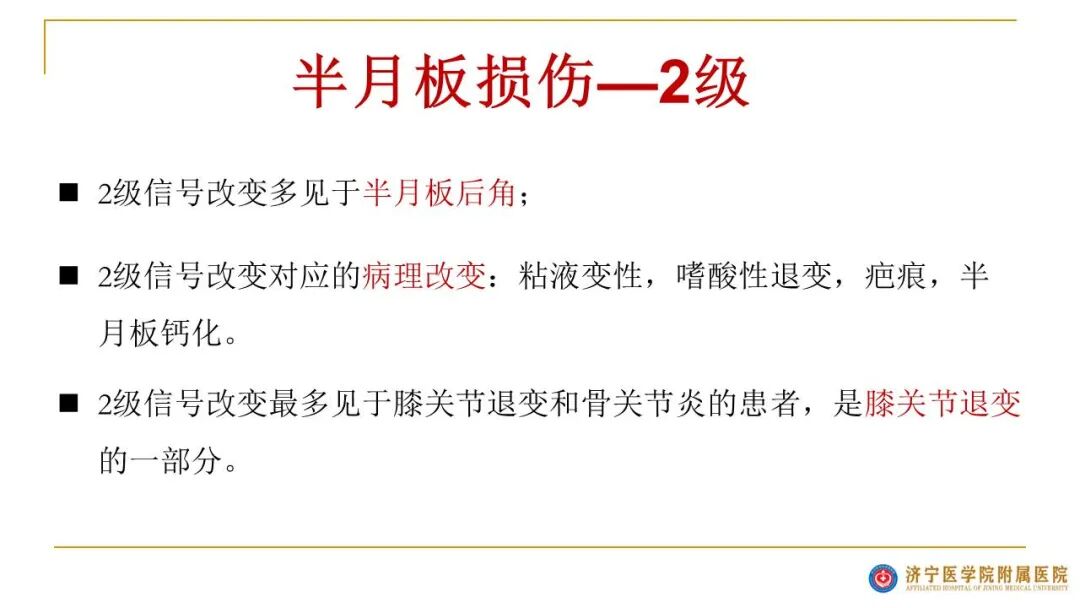 【图文并茂】膝关节MRI解剖及常见病诊断