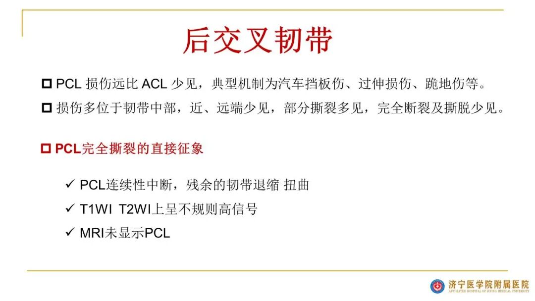 【图文并茂】膝关节MRI解剖及常见病诊断