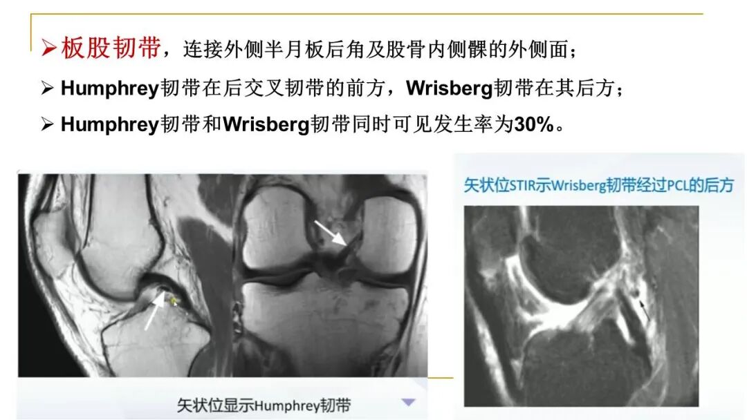 【图文并茂】膝关节MRI解剖及常见病诊断