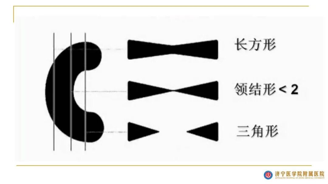 【图文并茂】膝关节MRI解剖及常见病诊断