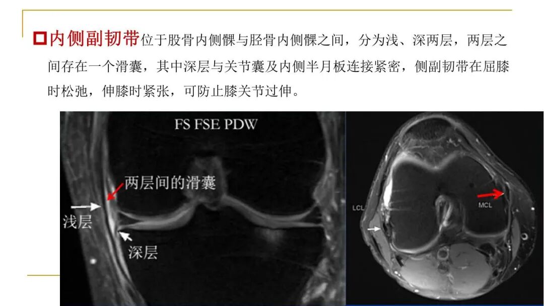 【图文并茂】膝关节MRI解剖及常见病诊断