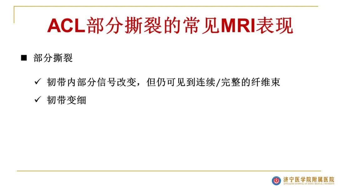 【图文并茂】膝关节MRI解剖及常见病诊断