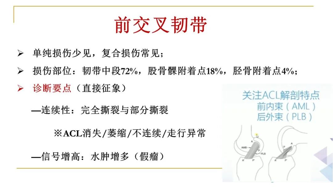 【图文并茂】膝关节MRI解剖及常见病诊断