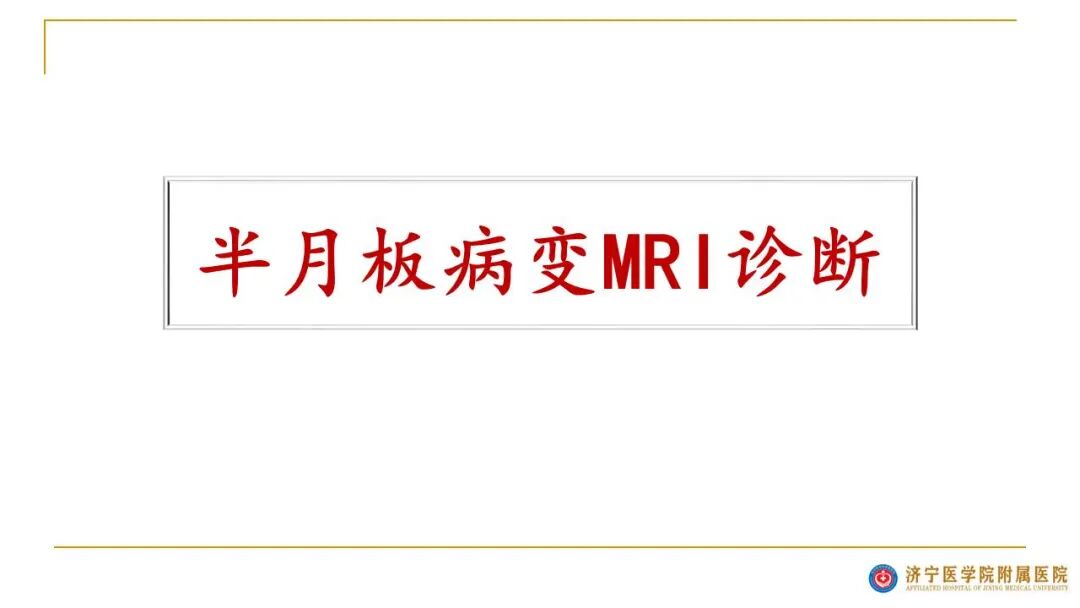 【图文并茂】膝关节MRI解剖及常见病诊断
