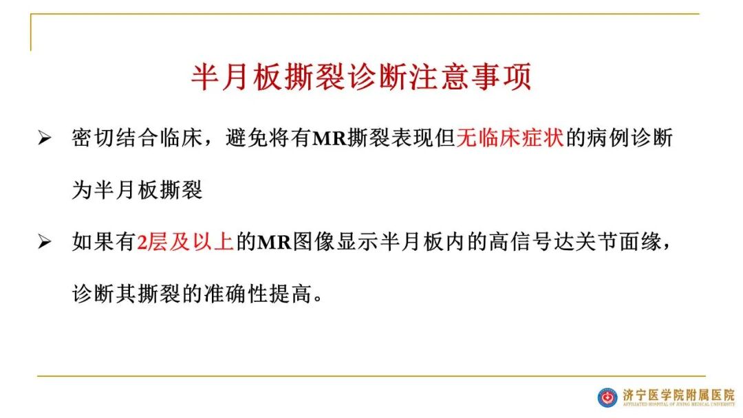 【图文并茂】膝关节MRI解剖及常见病诊断