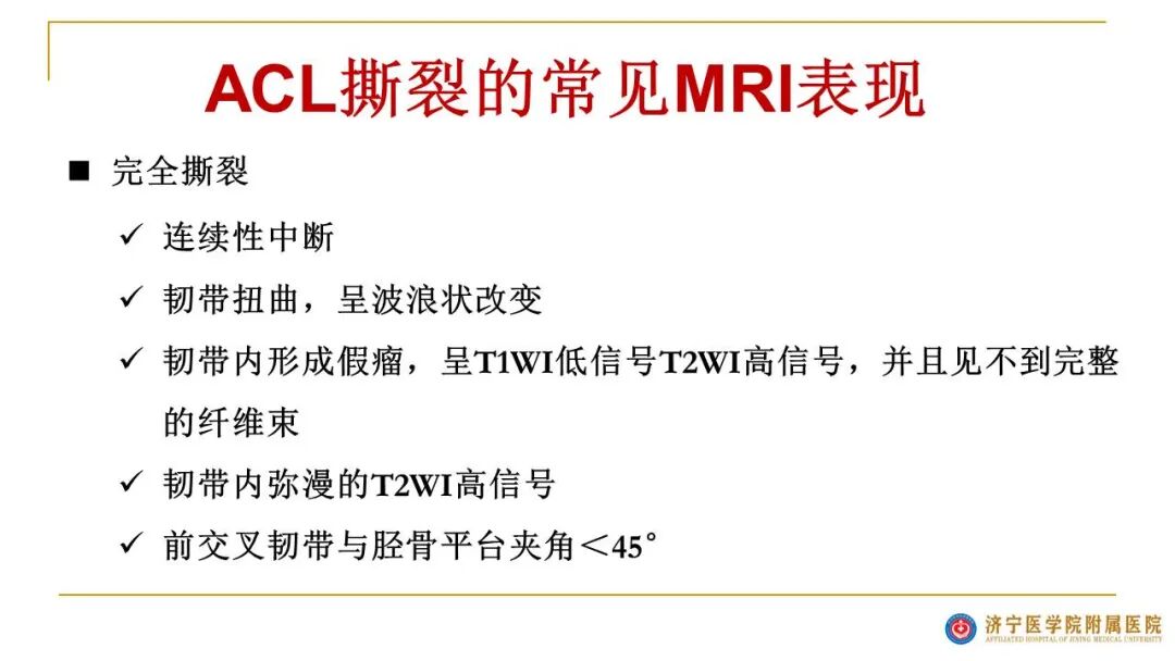 【图文并茂】膝关节MRI解剖及常见病诊断