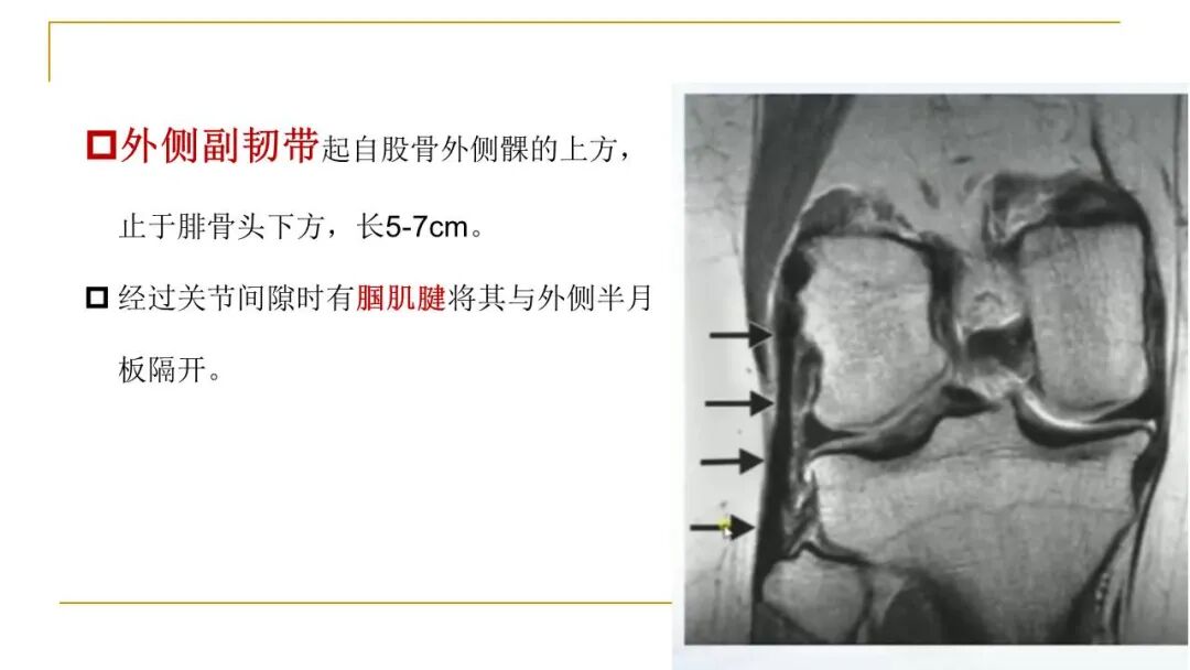 【图文并茂】膝关节MRI解剖及常见病诊断