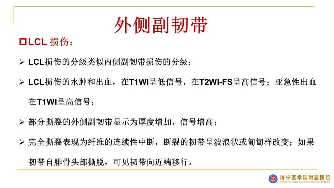 【图文并茂】膝关节MRI解剖及常见病诊断