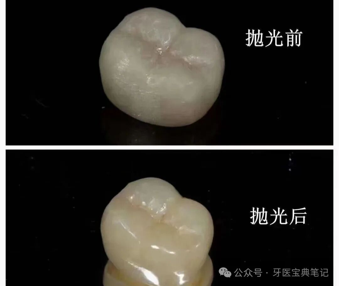 抛光，树脂延长寿命的关键技巧在这！