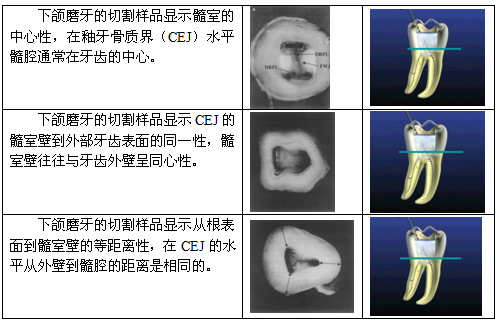 根管治疗的标准步骤，以及细节把握（长文收藏）