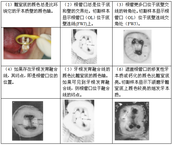 根管治疗的标准步骤，以及细节把握（长文收藏）