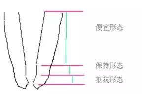 根管治疗的标准步骤，以及细节把握（长文收藏）